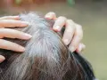 Dłonie dotykają siwiejących włosów, ukazując proces utraty melaniny. Co to melanina? To pigment odpowiedzialny za kolor włosów.