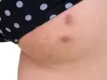 Krosty na pośladkach, widoczne pod czarnymi majtkami w białe kropki, wymagają uwagi.