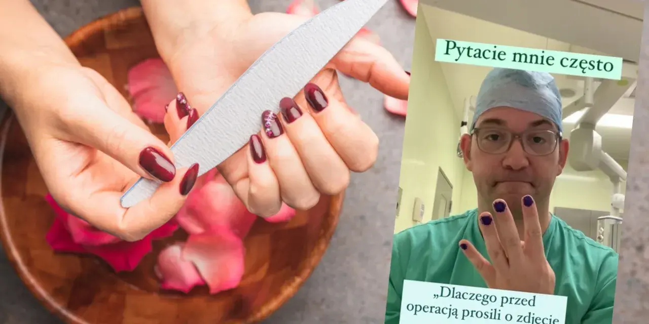 Paznokcie przed operacją? Lekarz w kitlu pokazuje pomalowane paznokcie, odpowiadając na pytanie, czy do operacji można mieć pomalowane paznokcie.