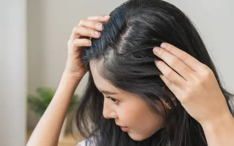 Kobieta dotyka swoich włosów, które wydają się być cienkie przy skórze głowy. Widać delikatne, jasne włoski, przypominające baby hair, które próbują odrosnąć.