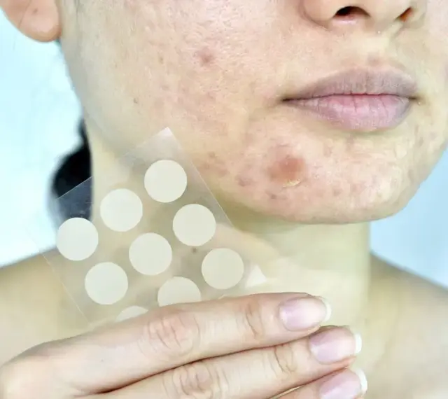 Dłoń trzyma arkusz z okrągłymi plastrami hydrokoloidowymi na pryszcze, gotowymi do użycia na skórze z niedoskonałościami.