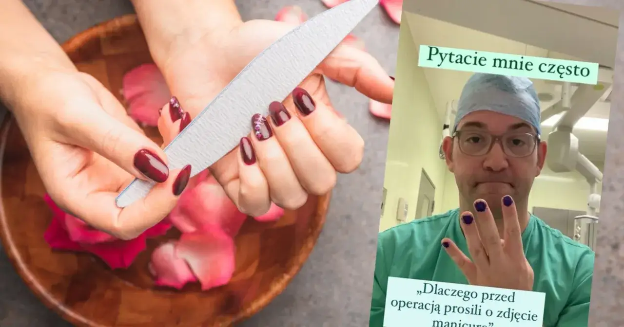 Paznokcie przed operacją? Lekarz w kitlu pokazuje swoje pomalowane paznokcie, odpowiadając na pytanie, czy do operacji można mieć pomalowane paznokcie.